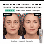 Reverse-Aging Temporary Eye Tightener: Younger Looking Eyes In 90 Seconds
