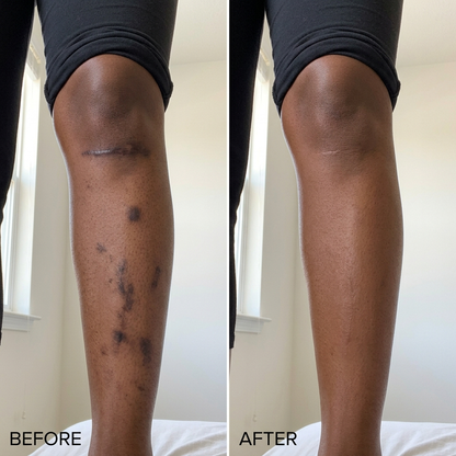 Rihisa™ Body Coverage Perfector