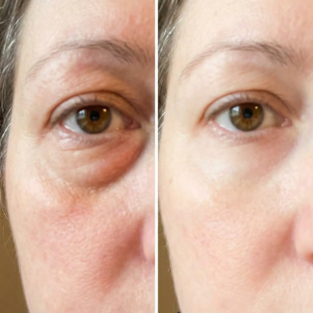 3. Depuffs Morning Eyebags In Minutes