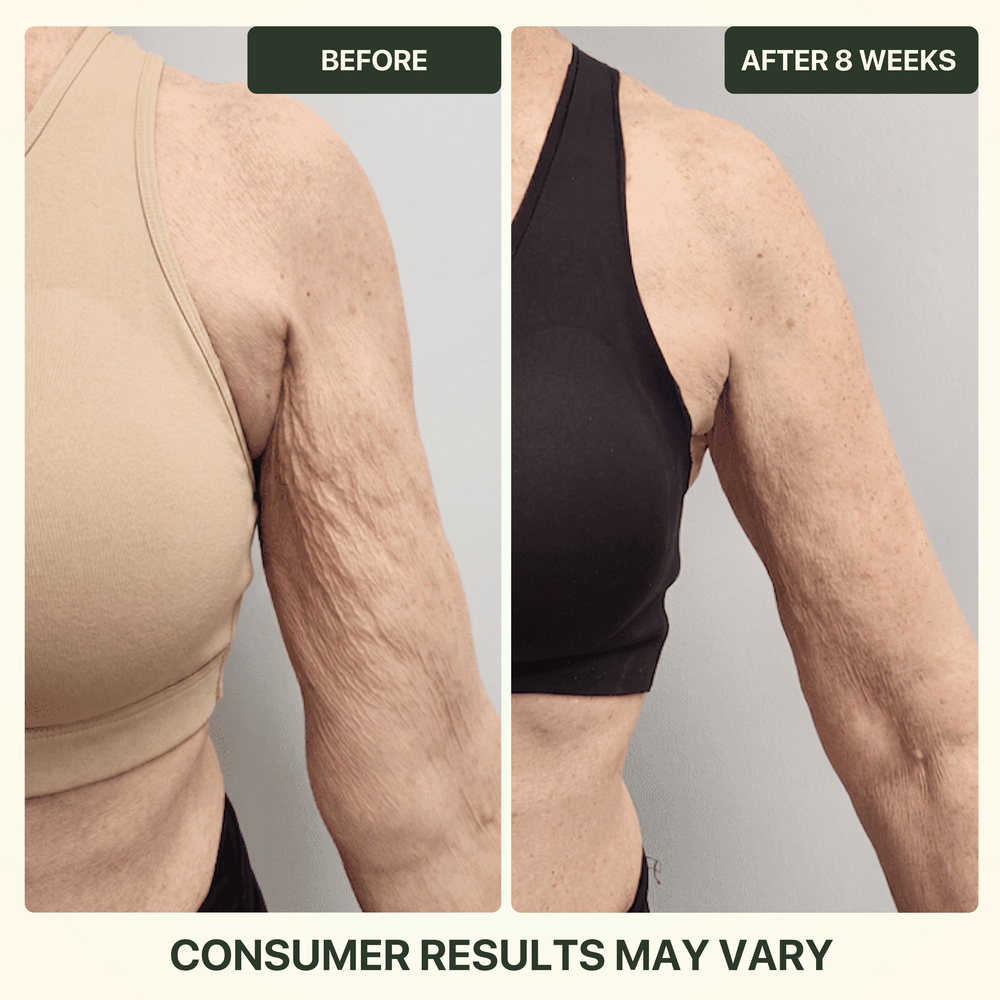 Before and after